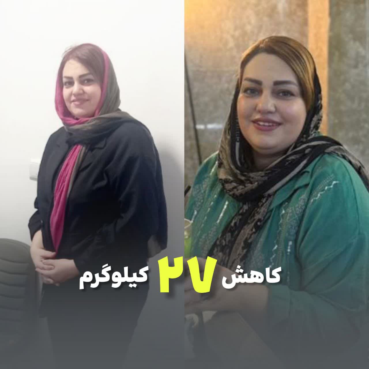 27 کیلو کاهش وزن در عرض 5 ماه بعد اسلیو . وزن اولیه 93 . وزن بعدی 65 کیلو